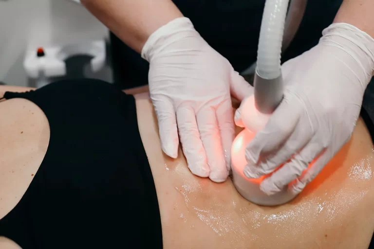 CryoSlimming Therapy being performed on woman's belly at Restore