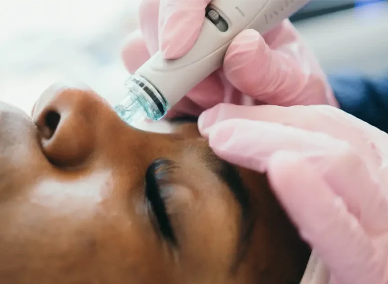 Woman getting a hydrafacial.