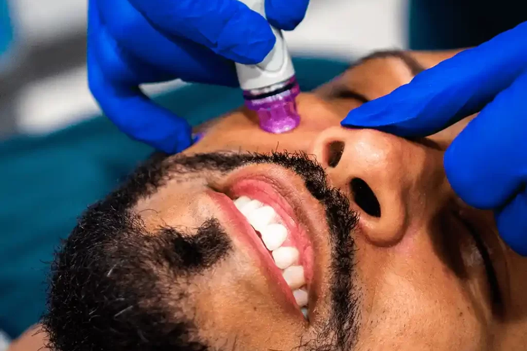 A bearded man getting a hydra facial.