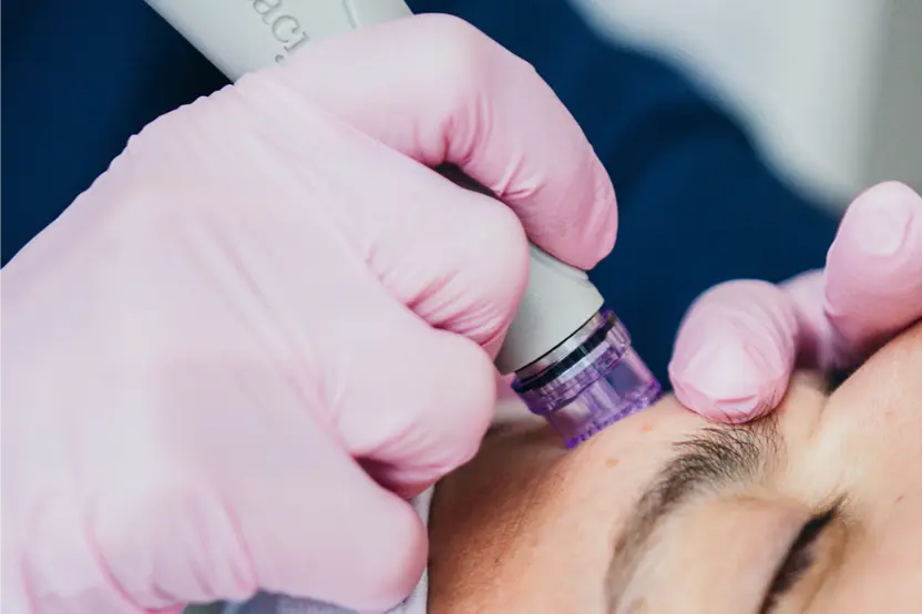 Close up of someone getting a hydra facial treatment.